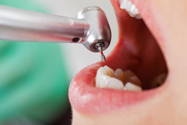 Best Broken Tooth Emergency  in Bayou Vista, TX